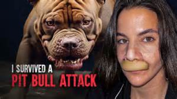 15 People In Boston Watch Boy, 7, Get Mauled To Death By Pit Bulls: ‘No One Knew What To Do’