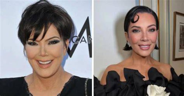 9 Times Celebs Have Confessed To Weird Surgeries: Kris Jenner Reducing Her Ear & More — PICS