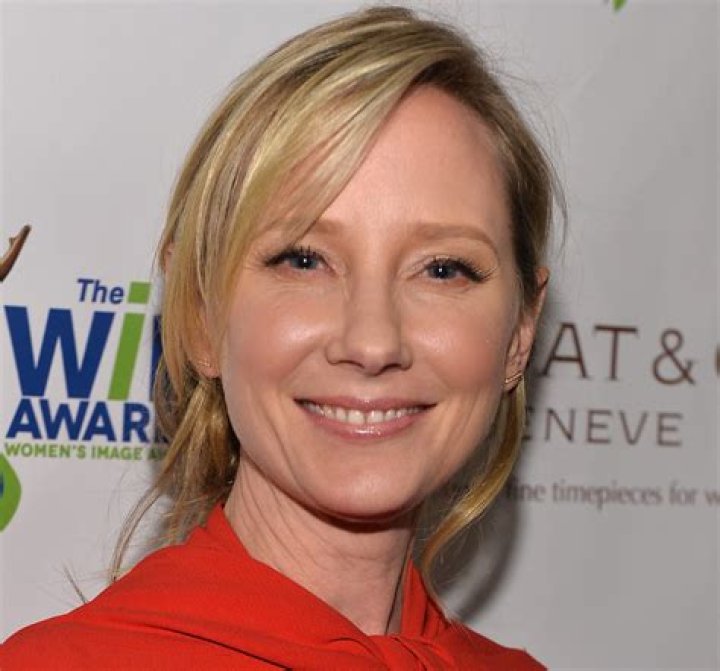 Anne Heche Declared Brain Dead & ‘Not Expected To Survive’ Following Car Crash