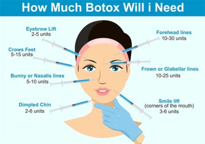 Botox In Your 20s — Why I Got The Treatment At Age 25 – Hollywood Life