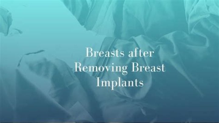 Chrissy Teigen Reveals She Wants Another Procedure To Make Breasts Smaller After Implant Removal