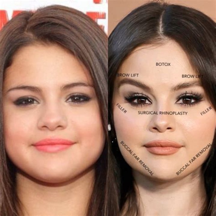 How It Changes Selena Gomez & Demi Lovato’s Faces – Hollywood Life