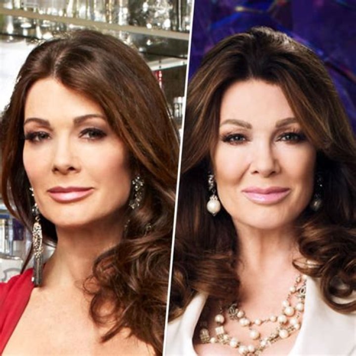Kyle Richards Claps Back After Lisa Vanderpump Shades Her ‘New Nose’ Amid Feud