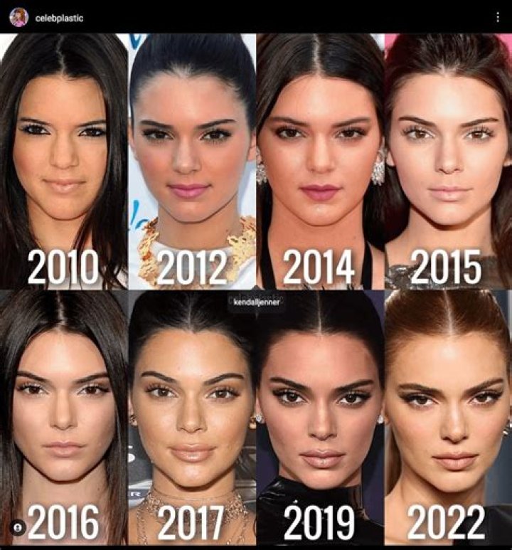 Kylie Jenner’s Face Through The Years — Lips & Makeup Changes – Hollywood Life