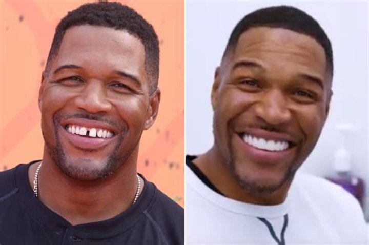 Michael Strahan Reveals If Fixed Tooth Gap Is A Joke – Hollywood Life