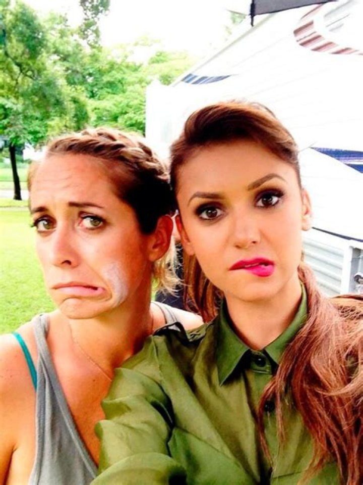 Nina Dobrev Helps Friend’s Burn Using Her Go-To Beauty Cream
