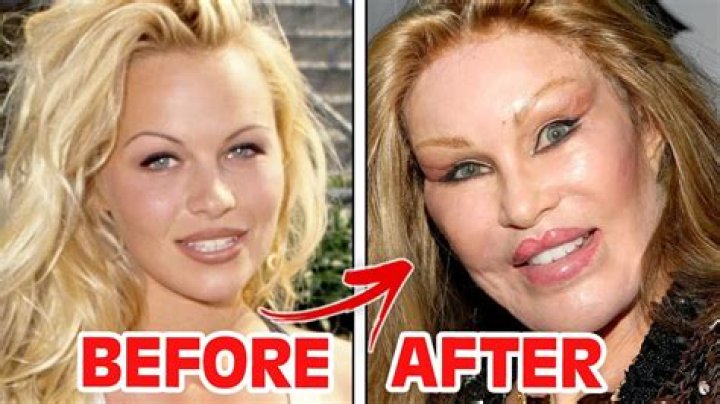 Plastic Surgery? — See Before & After Photos – Hollywood Life